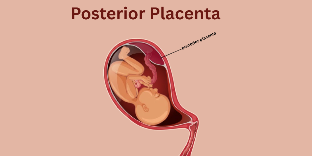 Understanding Posterior Placenta: Meaning, Grades, and Its Role in a Healthy Pregnancy