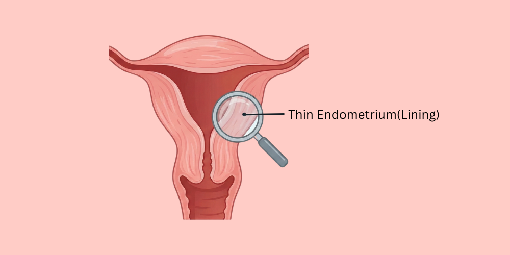 Best Treatments for Thin Endometrium: What Actually Works?