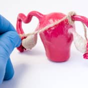 I'm diagnosed with PCOS