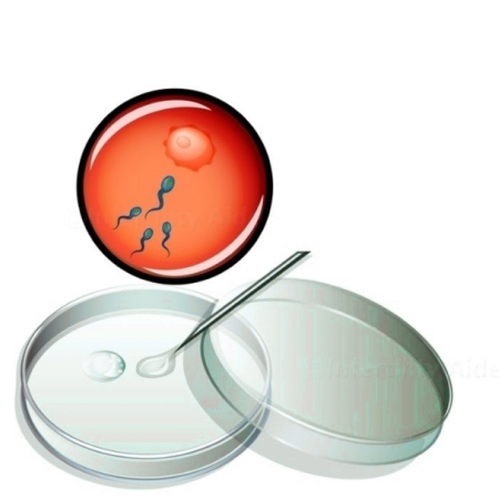 Best In Vitro Fertilization-IVF treatment